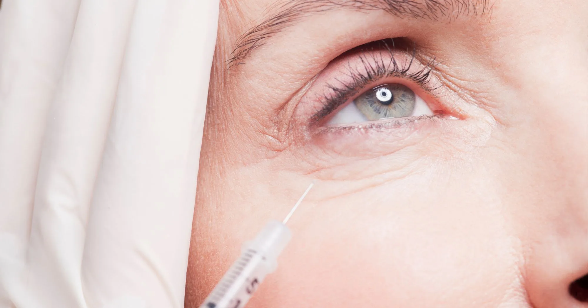 Under Eye Filler in Greenville, SC