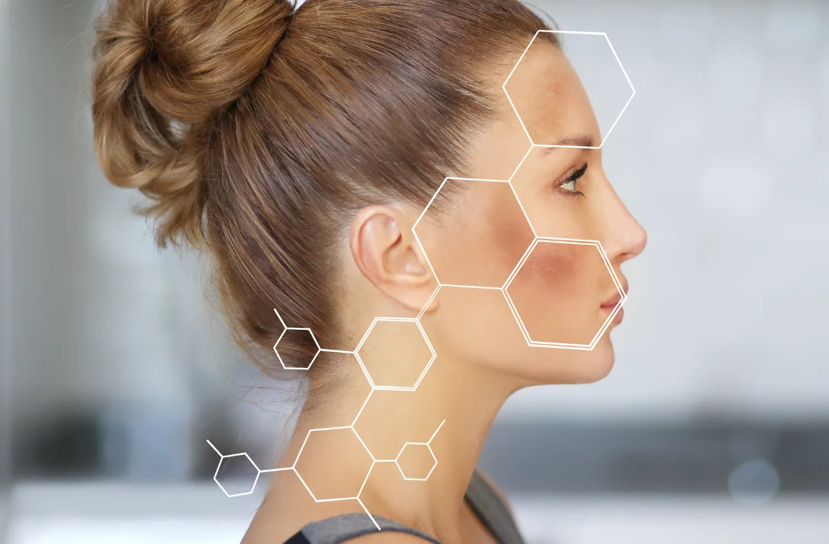 Best treatment for dark spots Greenville med spa