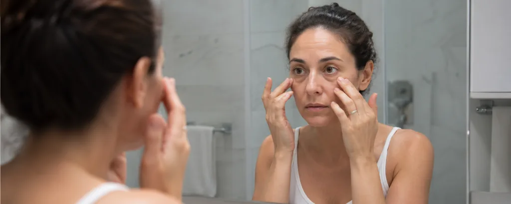 under eye filler Greenville SC